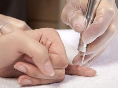 Durchführung einer Lasertherapie