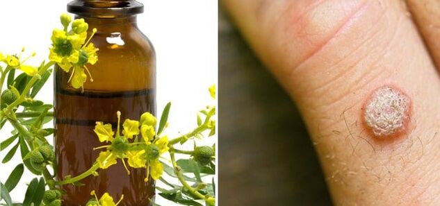 Behandlung von Warzen mit pharmazeutischem Schöllkraut